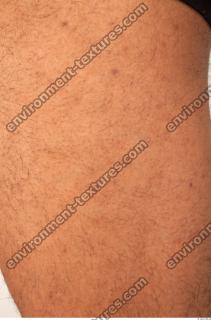 human skin hairy 0012